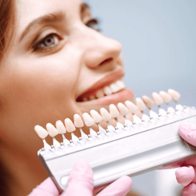 Everything You Need to Know About Composite Veneers