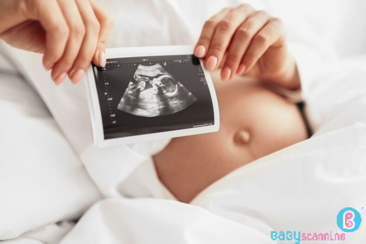 early pregnancy scan radiology