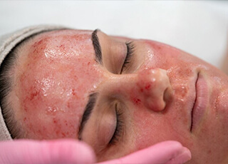 Find the Best Skin Specialist in Lahore for Clear and Healthy Skin