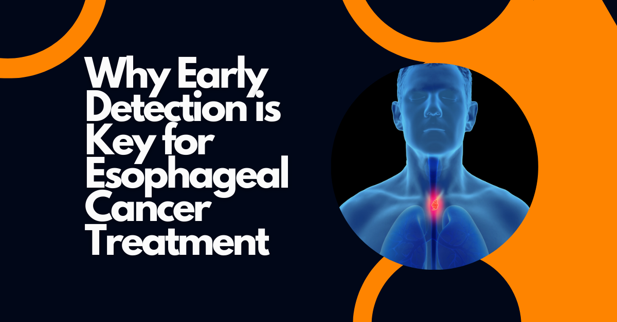 esophageal cancer best treatment