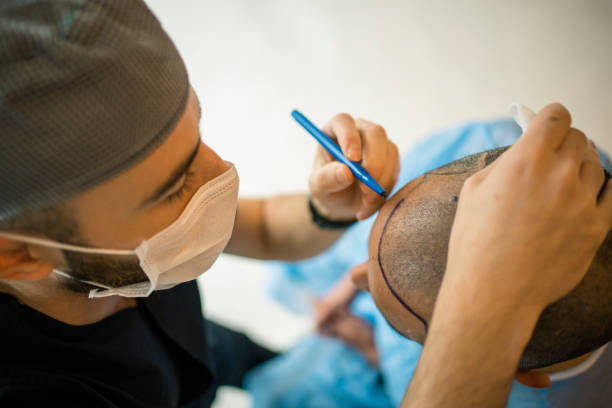 Hair Transplant Cost in Dubai for Different Procedures