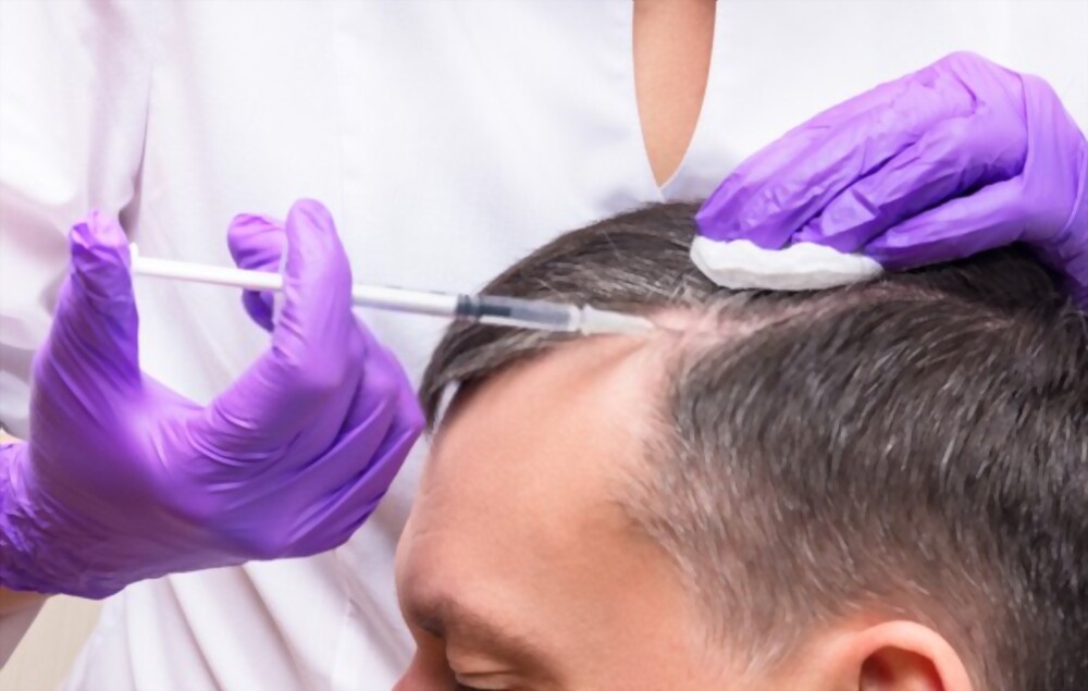 PRP hair treatment in Pune