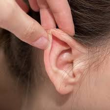 ear reshaping