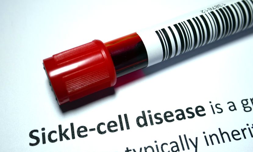 Sickle Cell Disease Treatment Market