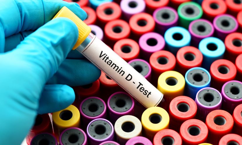 Vitamin D Testing Market Size, Share, Growth & Report 2032