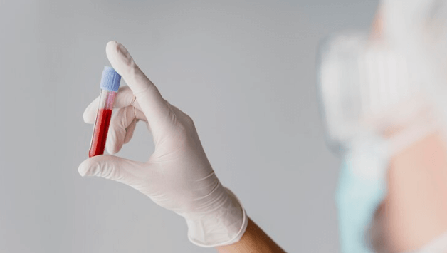 HIV blood test